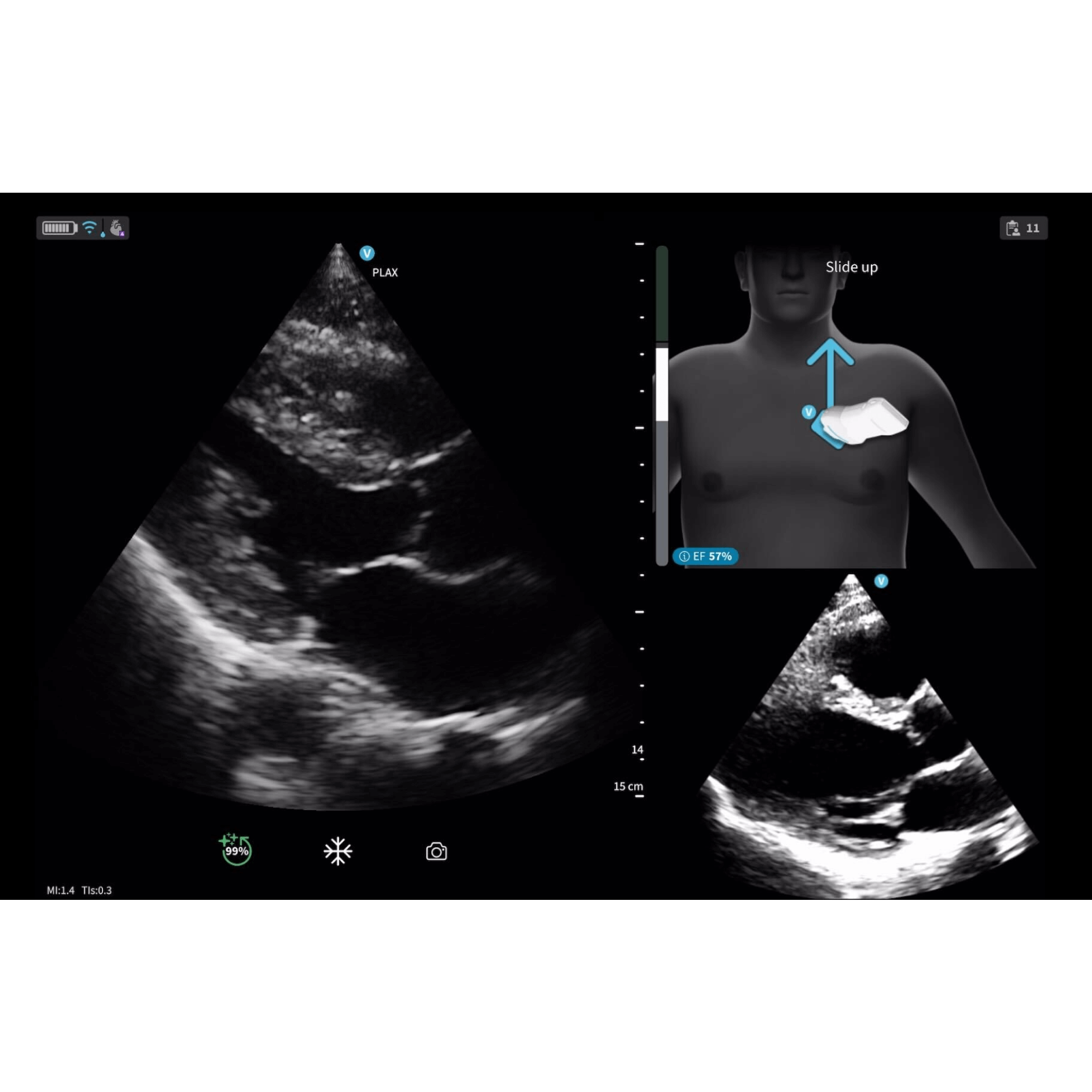 Vscan Air SL Caption AI (Stand-alone) FlexiPackage EUR